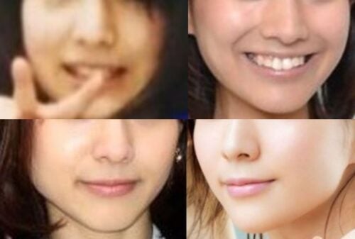 田中みな実の口