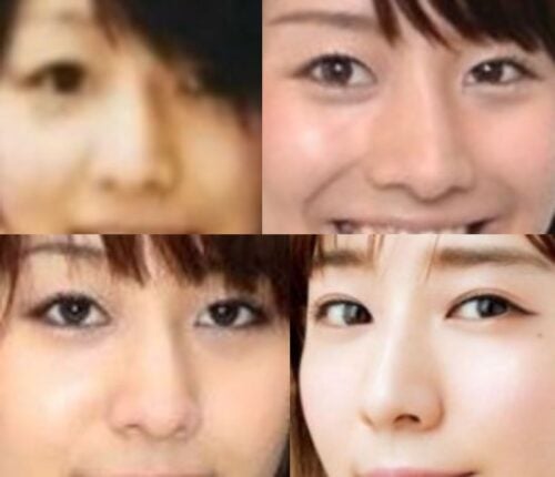 田中みな実の鼻