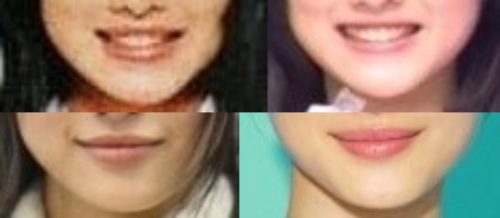 石原さとみの口