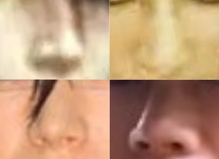 GACKTの鼻