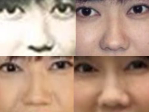 松本伊代の鼻