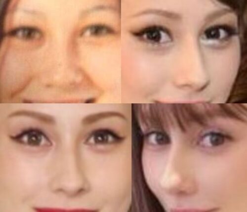 ダレノガレ明美の鼻