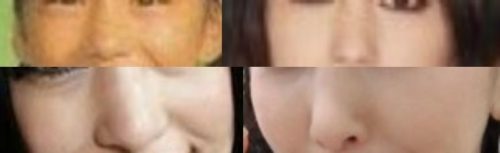 中島美嘉の鼻