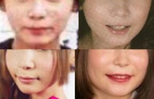 中川翔子（しょこたん）が整形か画像比較｜注目は「目」「フェイスライン」 | 整形の館〜芸能人の現在と昔を画像で比較〜