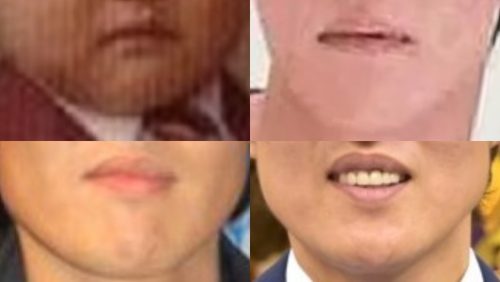 千原ジュニアの口