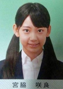 宮脇咲良が整形か画像比較｜注目は「目」「鼻」「顎」「フェイスライン」
