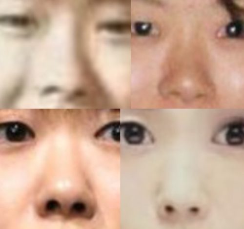小保方晴子の鼻