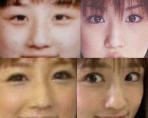 小倉優子の鼻