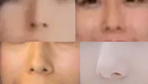 有村藍里の鼻