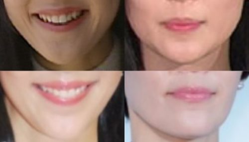 木村佳乃の口