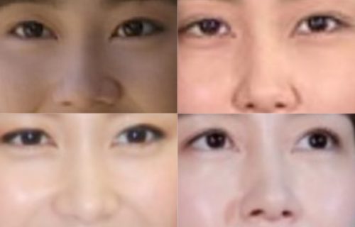 木村佳乃の鼻