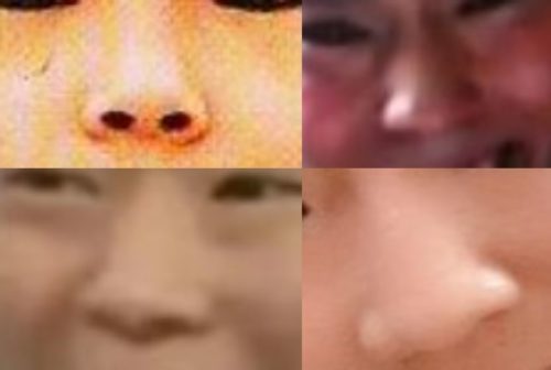 楽しんごの鼻