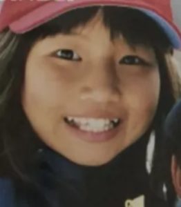 今井メロが整形か画像比較｜注目は「目」「鼻」「フェイスライン」