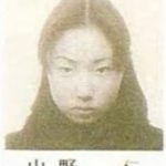 MEGUMIが整形か画像比較｜注目は「目」「顎」