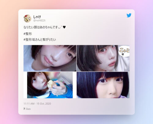 あのちゃんの整形