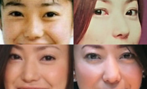 菅野美穂の鼻