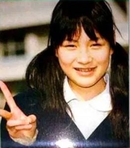 のん（能年玲奈）が整形か画像比較｜注目は「目」「鼻」