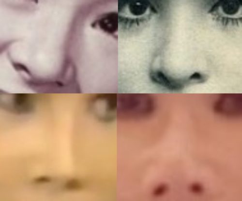弘田三枝子の鼻