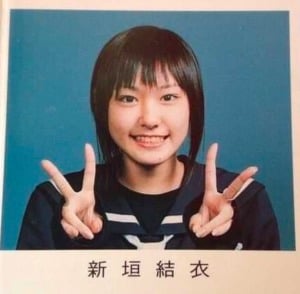 新垣結衣（ガッキー）が整形か画像比較｜注目は「目」「鼻」「顎」