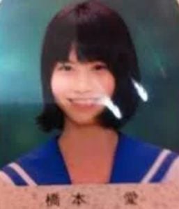 橋本愛（1996年生）が整形か画像比較｜注目は「目」「鼻」「唇」「エラ」「顎」