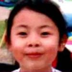 渡辺直美が整形か画像比較｜注目は「目」「顎」