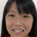 白間美瑠（みるるん）が整形か画像比較｜注目は「目」「鼻」