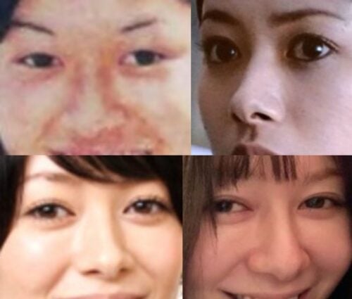 真木よう子の鼻