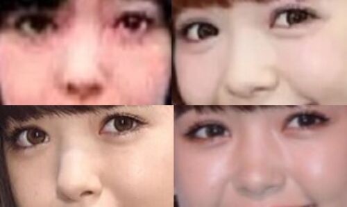 藤田ニコルの鼻