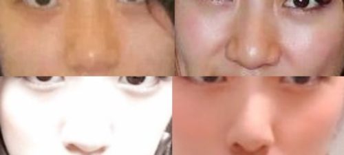 高橋みなみの鼻