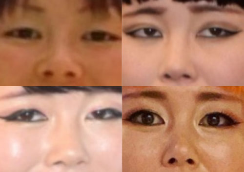 ブルゾンちえみの鼻