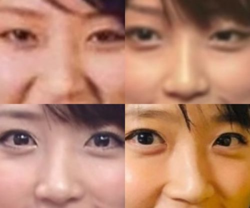 竹内由恵の鼻