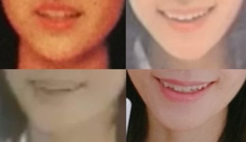 細川直美の口