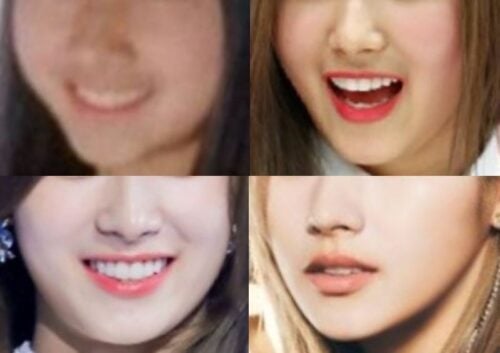 TWICEサナの口