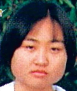 しずちゃんが整形か画像比較｜注目は「目」「顎」