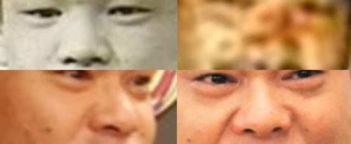 ジミー大西の鼻