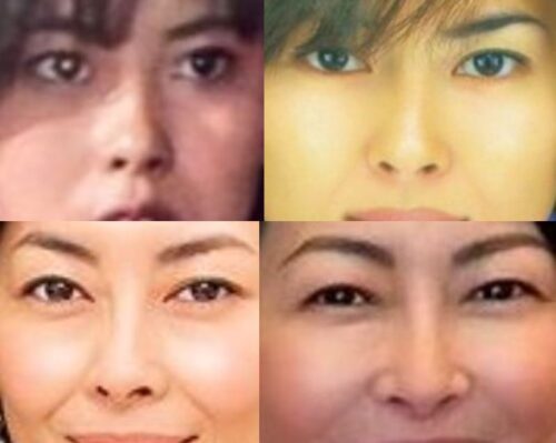 中山美穂の鼻