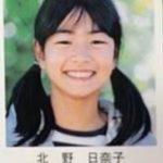 北野日奈子が整形か画像比較｜注目は「目」