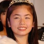 小芝風花が整形か画像比較｜注目は「目」「唇」「顎」