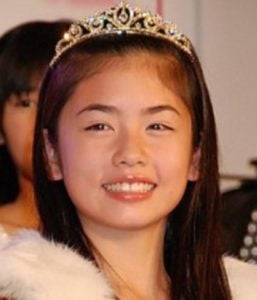 小芝風花が整形か画像比較｜注目は「目」「唇」「顎」
