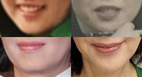 戸田恵子の口