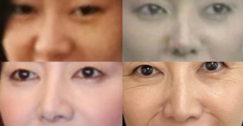 戸田恵子の鼻