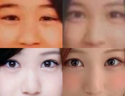 星野みなみの鼻