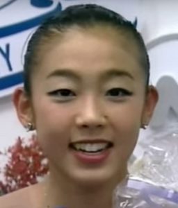 村主章枝が整形か画像比較｜注目は「目」「鼻」「唇」「顎」