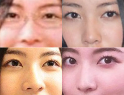 松井珠理奈の鼻