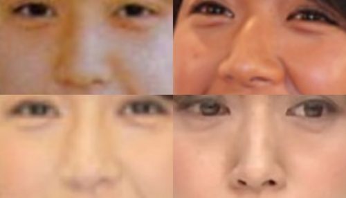 浅尾美和の鼻