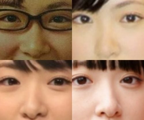 生駒里奈の鼻