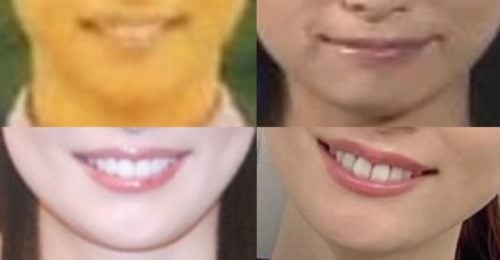 皆藤愛子の口