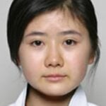 福原愛が整形か画像比較｜注目は「目」「鼻」「フェイスライン」