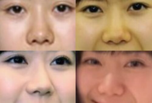 福原愛の鼻
