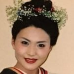 金子恵美が整形か画像比較｜注目は「目」「鼻」「顎」